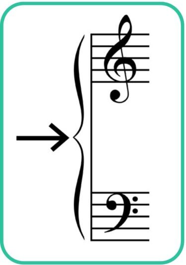 Musical braces